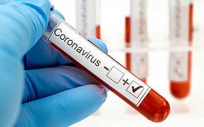 Brasil ultrapassa 101 mil casos de coronavírus, com 7.025 mortes
