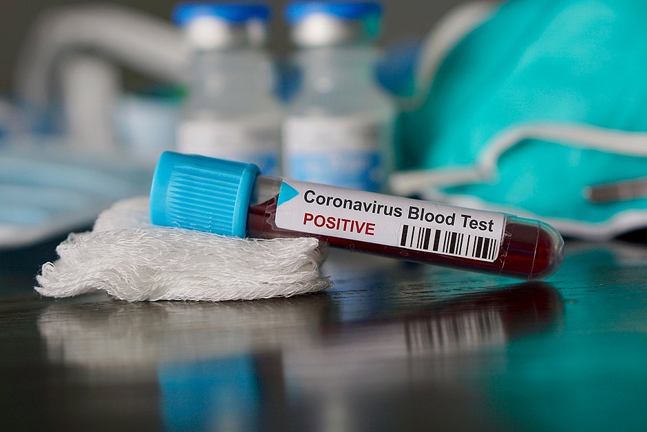 São Paulo vai produzir vacina contra o novo coronavírus ...