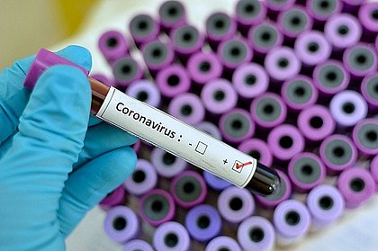 Bebê com 5 dias de vida morre vítima do coronavírus em Natal