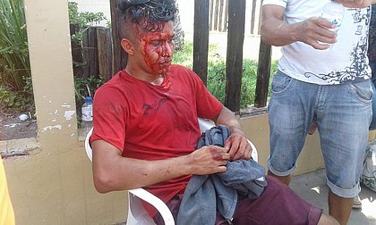 Estudante foi assaltado e levou pedrada quando ia fazer prova do Enem 2018, em Macapá
